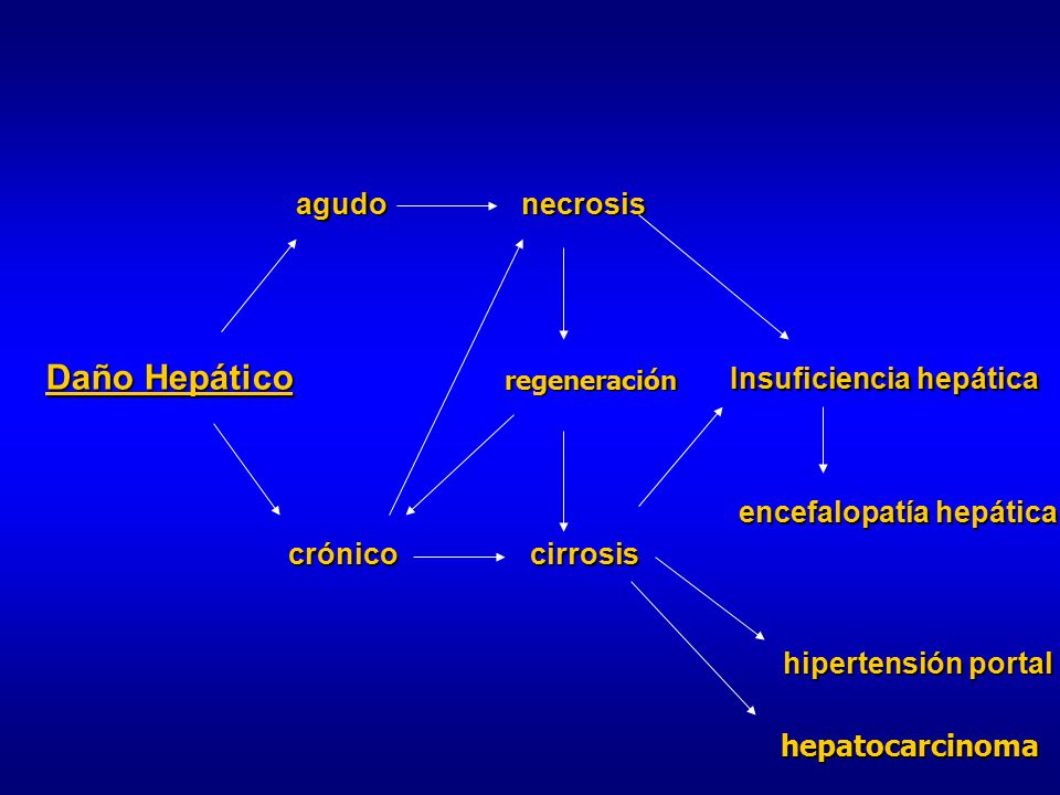 Portal de cirrosis hipertensión icd-9